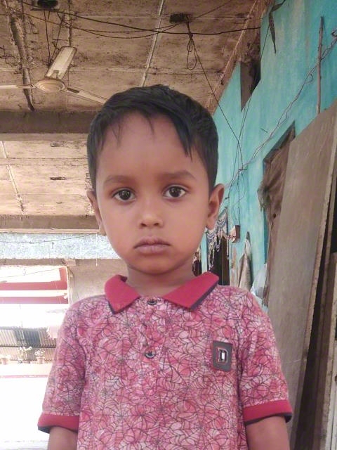 World Vision India
